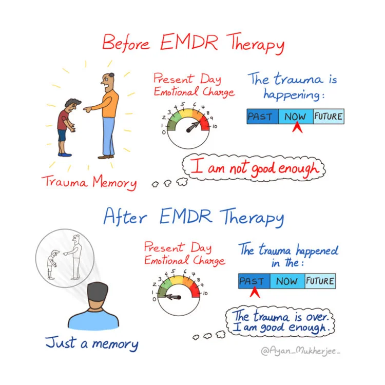 before after therapy emr cork